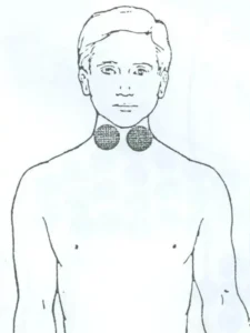 بادکش تیروئید