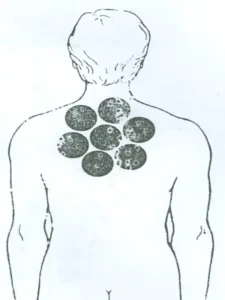 بادکش خورشیدی