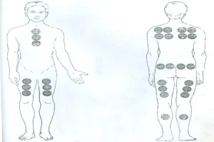 بادکش خونساز