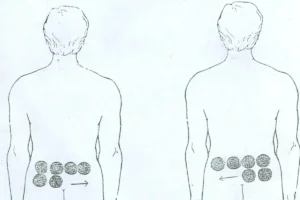 بادکش دیسک انحراف