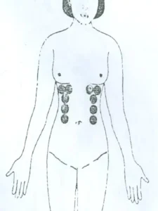 بادکش زیر سینه