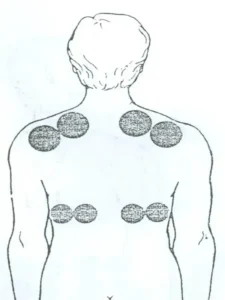 بادکش قله و قاعده ریه