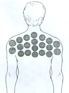 بادکش وسیع کتف