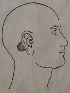 بادکش پشت گوش