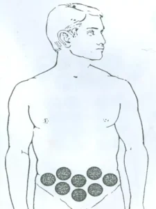 بادکش پوبیس