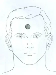 بادکش پیشانی