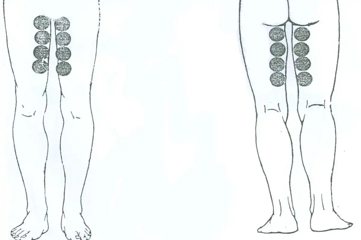 بادکش کشاله ران