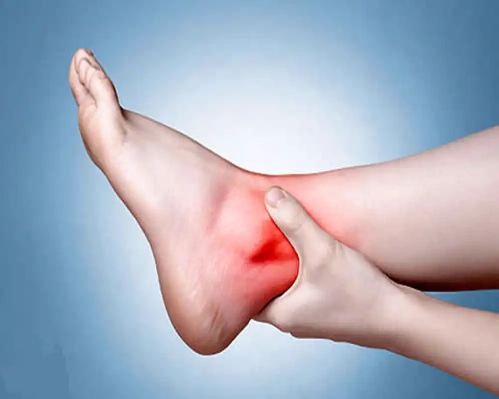 درمان ورم بدن در طب سنتی